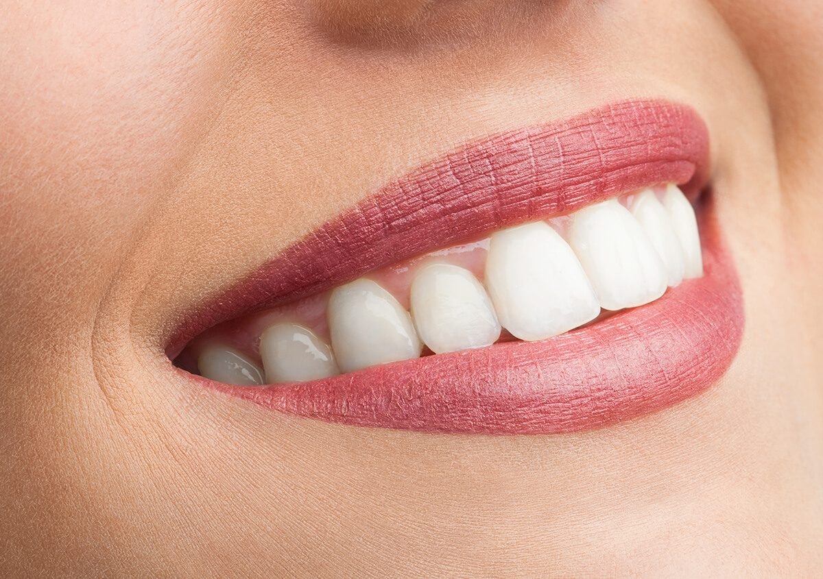 Are Teeth Whitening Kits Safe in Toms River NJ Area